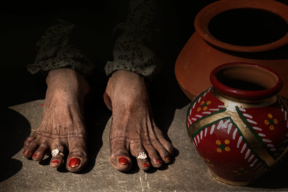 e194c5d14a78d9bca75edb00b9a36666_1773168